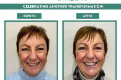 Before-and-After-C4DE-August-2026