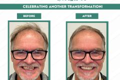 Before-and-After-C4DE-July-2026