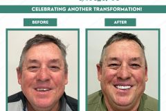 Before-and-After-September-2026-b