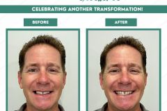 Before-and-After-September-2026