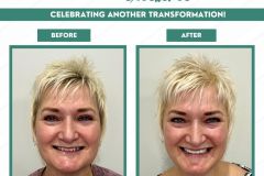 Before-and-After-September-3