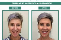 C4DE-Before-After-December-20265