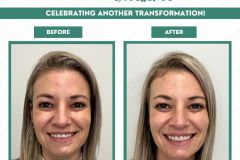 C4DE-Before-and-After-August-2026