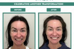 C4DE-Before-and-After-March-2026