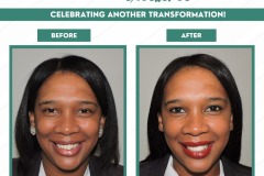 beforeandafter
